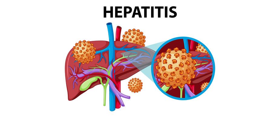 How is Hepatitis Transmitted